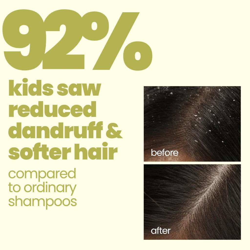 TuCo® Kids Flake Fighter Anti Dandruff Shampoo | Dry & Itchy Scalp | Paraben & SLS Free |100ml (pack of 1)