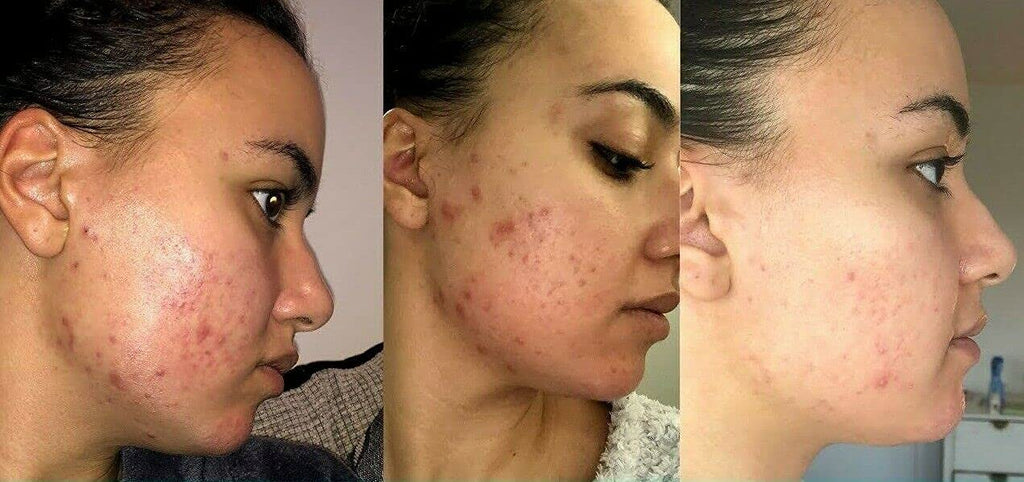Re-tinol Face Gel 0.1 (20 gm)