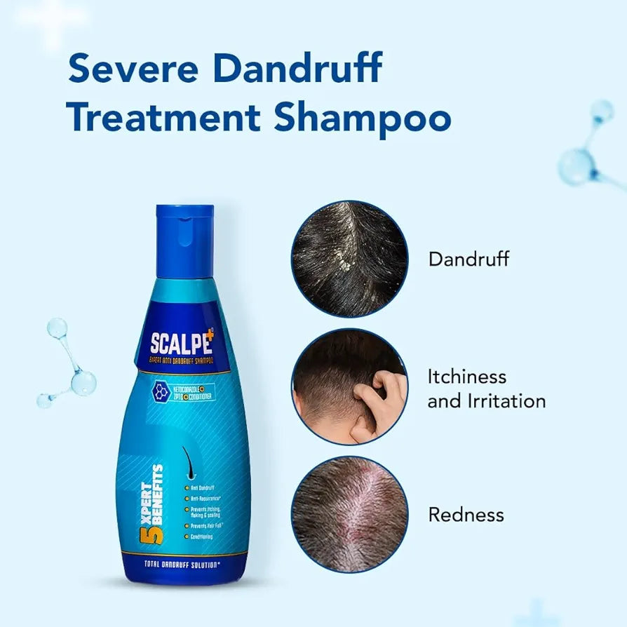 Scalpe+ Expert Anti Dandruff Shampoo for Men and Women - 150 ml