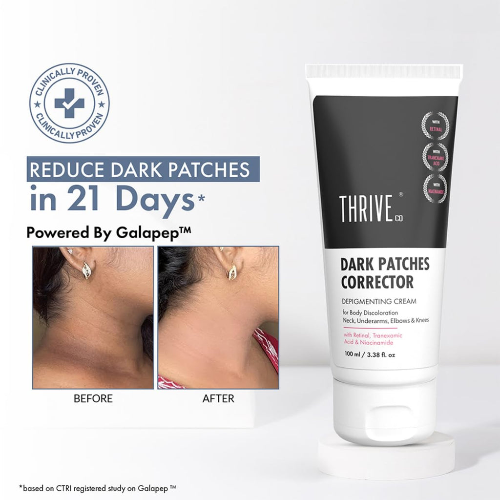 ThriveCo Dark Patches Corrector Cream | Dark Patches Removal | With Retinal & Niacinamide.. For Underarms, Inner Thighs, Knuckles, Elbows & Knees. Men & Women | 100ml
