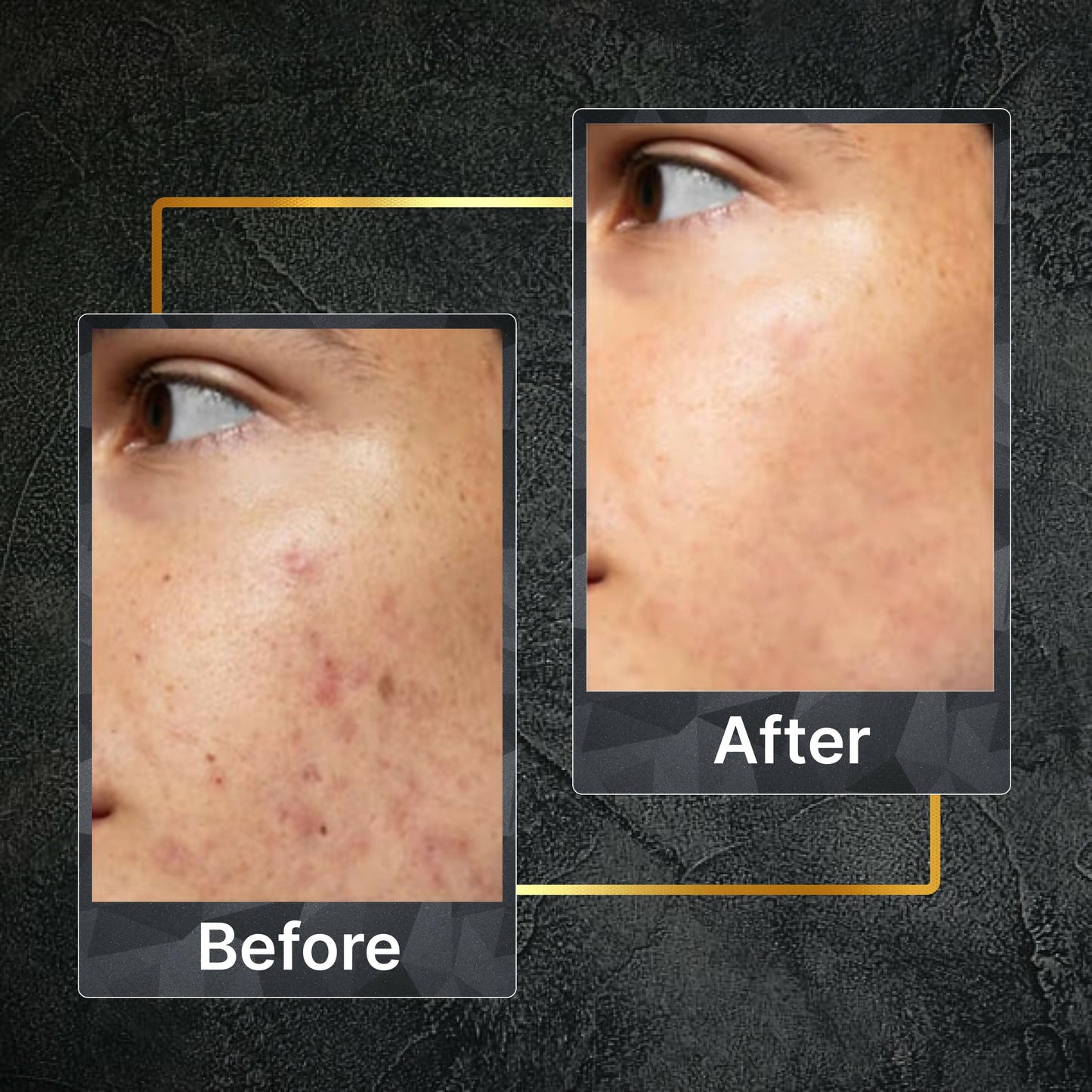 Tru Hair & Skin Nanotechnology Facewash For Sensitive-Acne Prone Skin