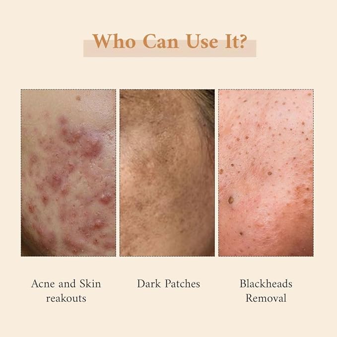 Zanya Face Scrub & Mask - 75 Gms