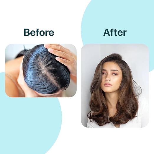 Rahul Phate's Seb-Control Shampoo - 200 ml
