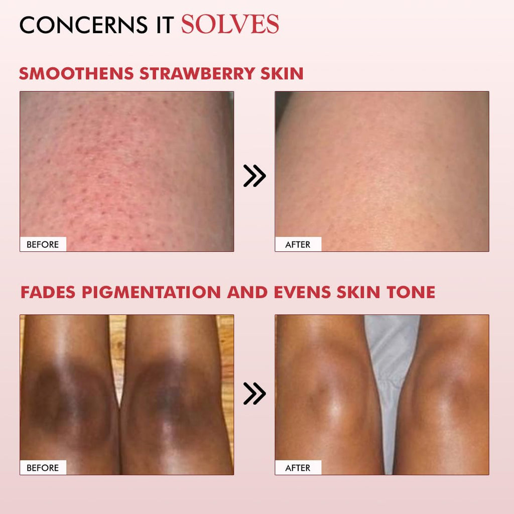 mCaffeine 11% AHA BHA Strawberry Body Lotion for Skin Smoothening | Gently Exfoliates Dead, Dry, Even Tones Skin | 72hr Moisturization | Juicy Strawberry Scent, For Men & Women-200ml