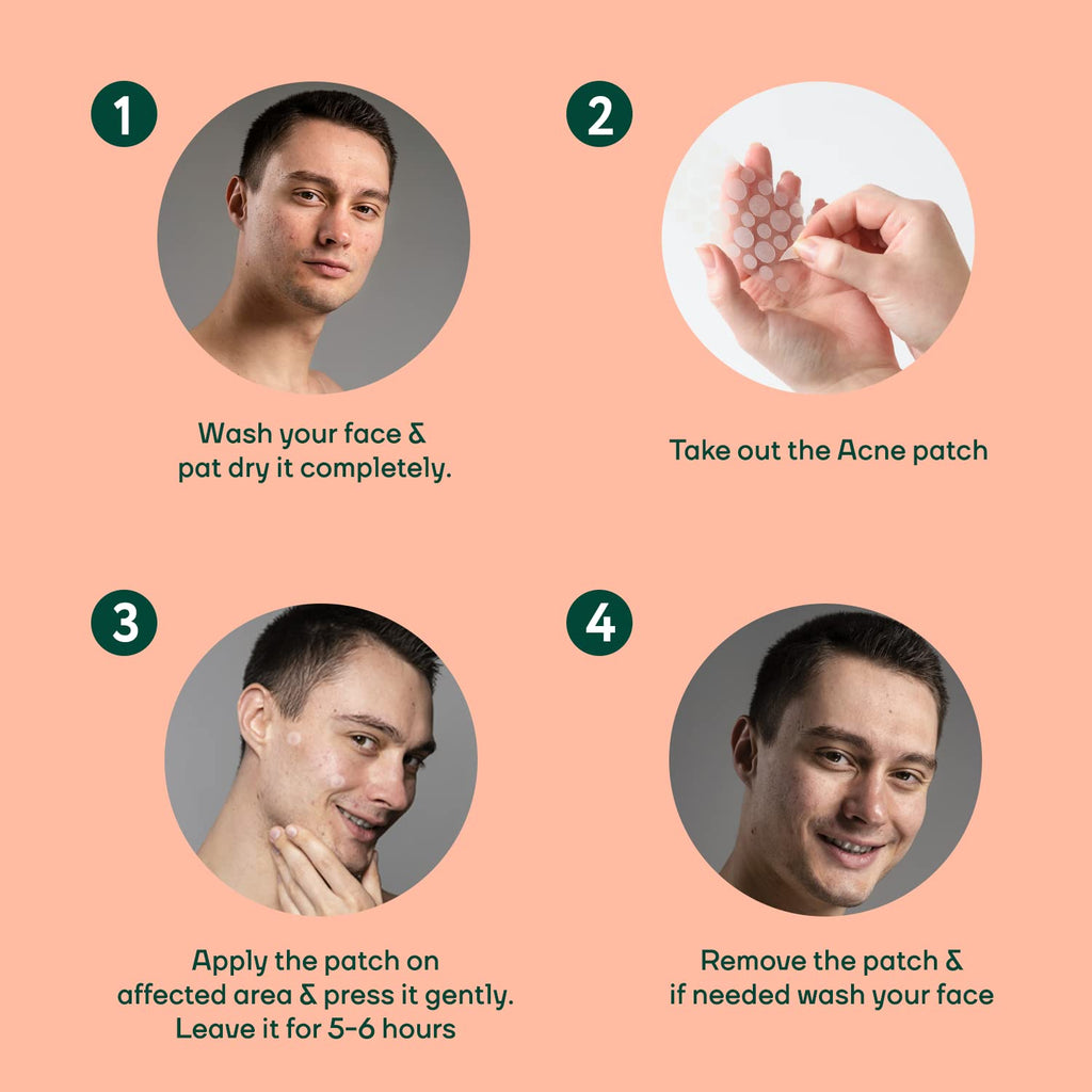 MOUNTAINORÂ® Acne Pimple Patch For Men - Hydrocolloid + Tea Tree Oil Potent Spot Cover, Fast Breakout Healing, Overnight Removal Of Acne Gunk, Waterproof Invisible Patches, Safe & Certified 72 Patches.