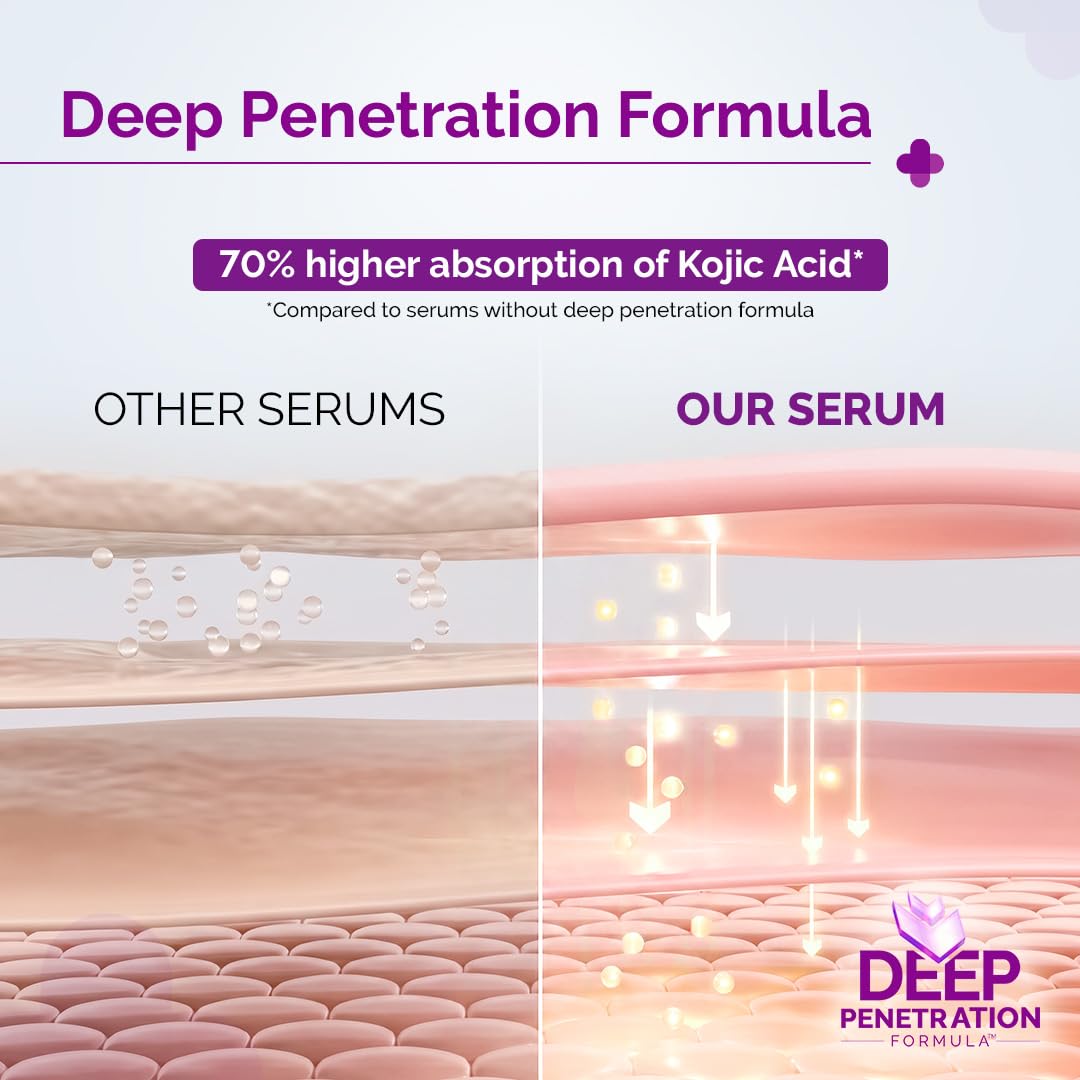 The Derma Co. 2% Kojic Acid Face Serum with Alpha Arbutin, Powered by Deep Penetration Formula™ | Fights Pigmentation | Fades Dark Spots | Brightens & Evens Skin Tone | 10 ml
