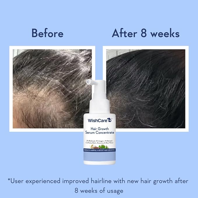 WishCare Hair Growth& Anti Hairfall Range with Serum Shampoo & Conditioner Combo Pack