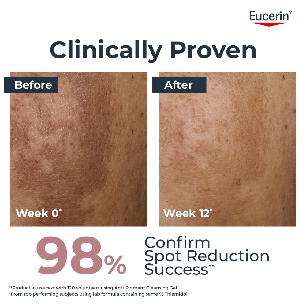 Eucerin Anti Pigment Cleansing Gel 2% Exfoliating AHA Complex 200ml