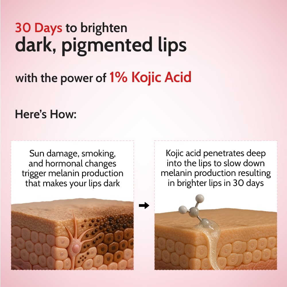 Chemist At Play Tinted Cherry Lip Balm with SPF 50 PA++++ | 1% Kojic Acid | Lip-balm for Dark and Dry Lips | Moisturising Lip Balm for Chapped Lip | Brightens Dark Lips | For Men & Women | 4.5 g