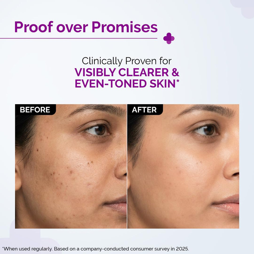 The Derma Co 10% Niacinamide Serum with 2% Zinc, Powered by Deep Penetration Formulaâ„¢ | Fades Acne Marks, Controls Oil & Reduces Dark Spots | 10 ml