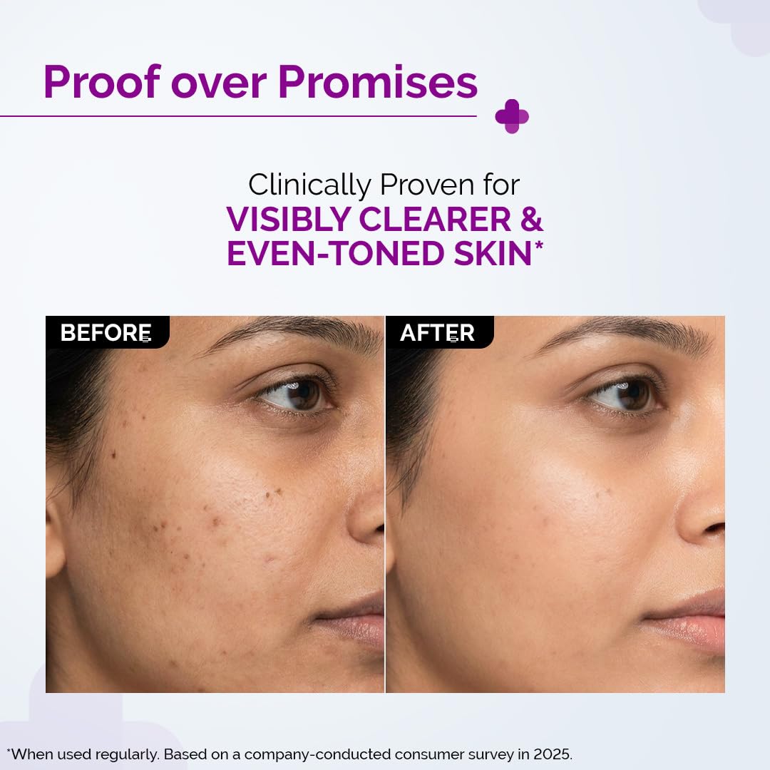The Derma Co 10% Niacinamide Serum with 2% Zinc, Powered by Deep Penetration Formulaâ„¢ | Fades Acne Marks, Controls Oil & Reduces Dark Spots | 10 ml