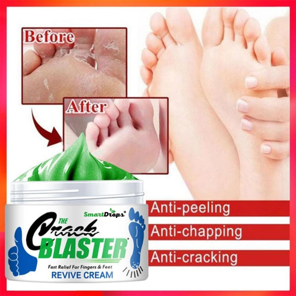 Smartdrops Foot Cream Deeply Moisturizes and Softens Feet & Elbow Skin - 50gm