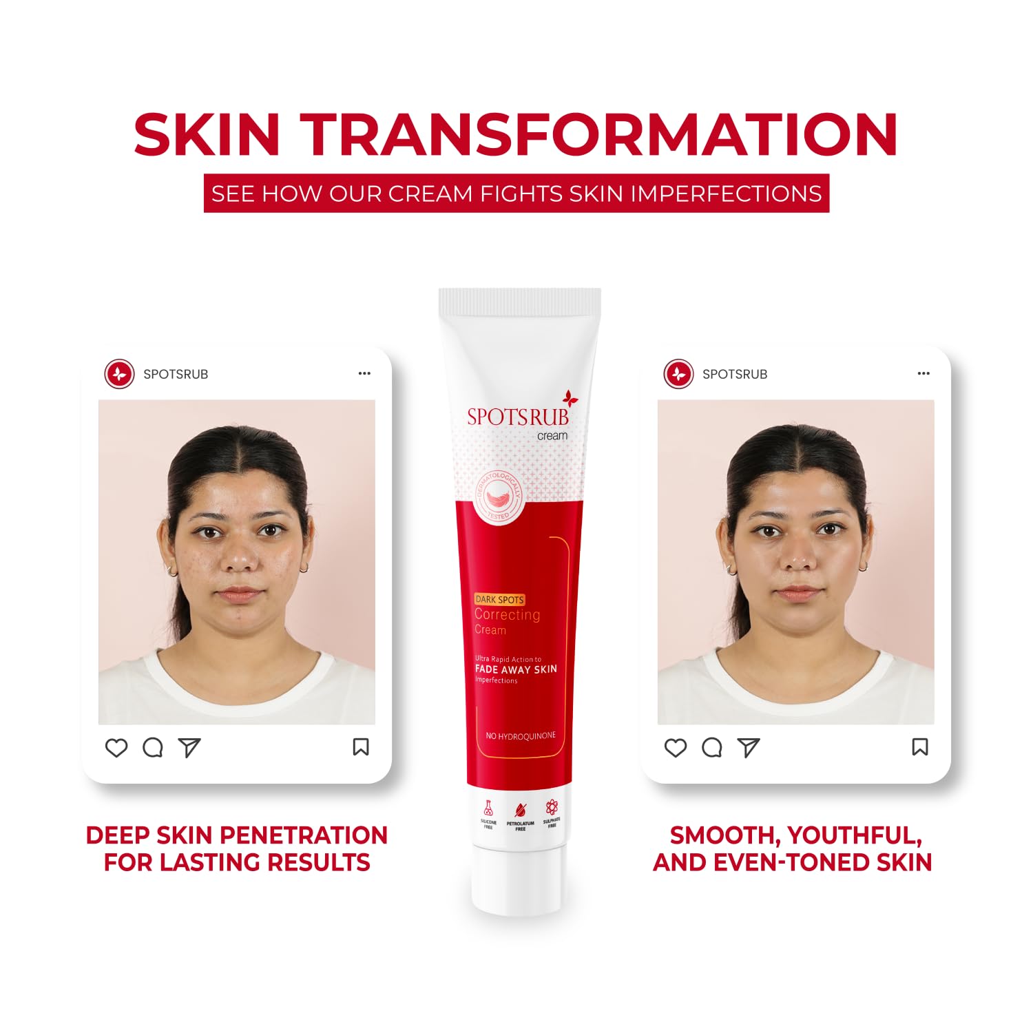 Leeford Spotsrub Face Cream for Women 15g - with 2% Kojic Acid and Vitamin C | Hydroquinone Free | Helps to Remove Pimples and Dark spots