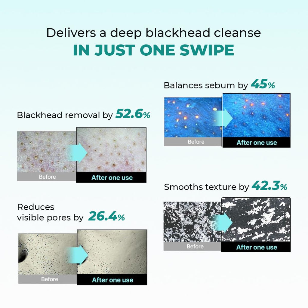 Conscious ChemistÂ® Blackhead Melting Water 130ml + Silicone Brush | Gentle Pore Treatment with Succinic, Glycolic Acid & CICA Exosome | Unclogs Pores, Removes Blackheads & Smoothens Skin | For Men & Women