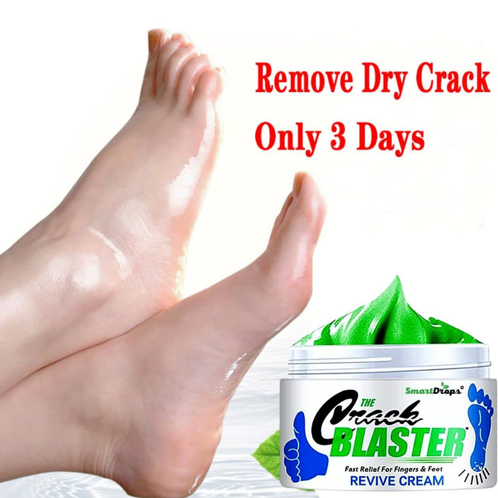 Smartdrops Foot Cream Deeply Moisturizes and Softens Feet & Elbow Skin - 50gm