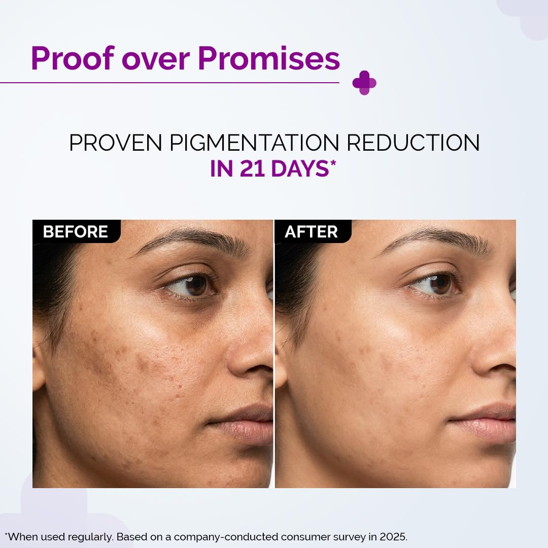 The Derma Co. 2% Kojic Acid Face Serum with Alpha Arbutin, Powered by Deep Penetration Formula™ | Fights Pigmentation | Fades Dark Spots | Brightens & Evens Skin Tone | 10 ml