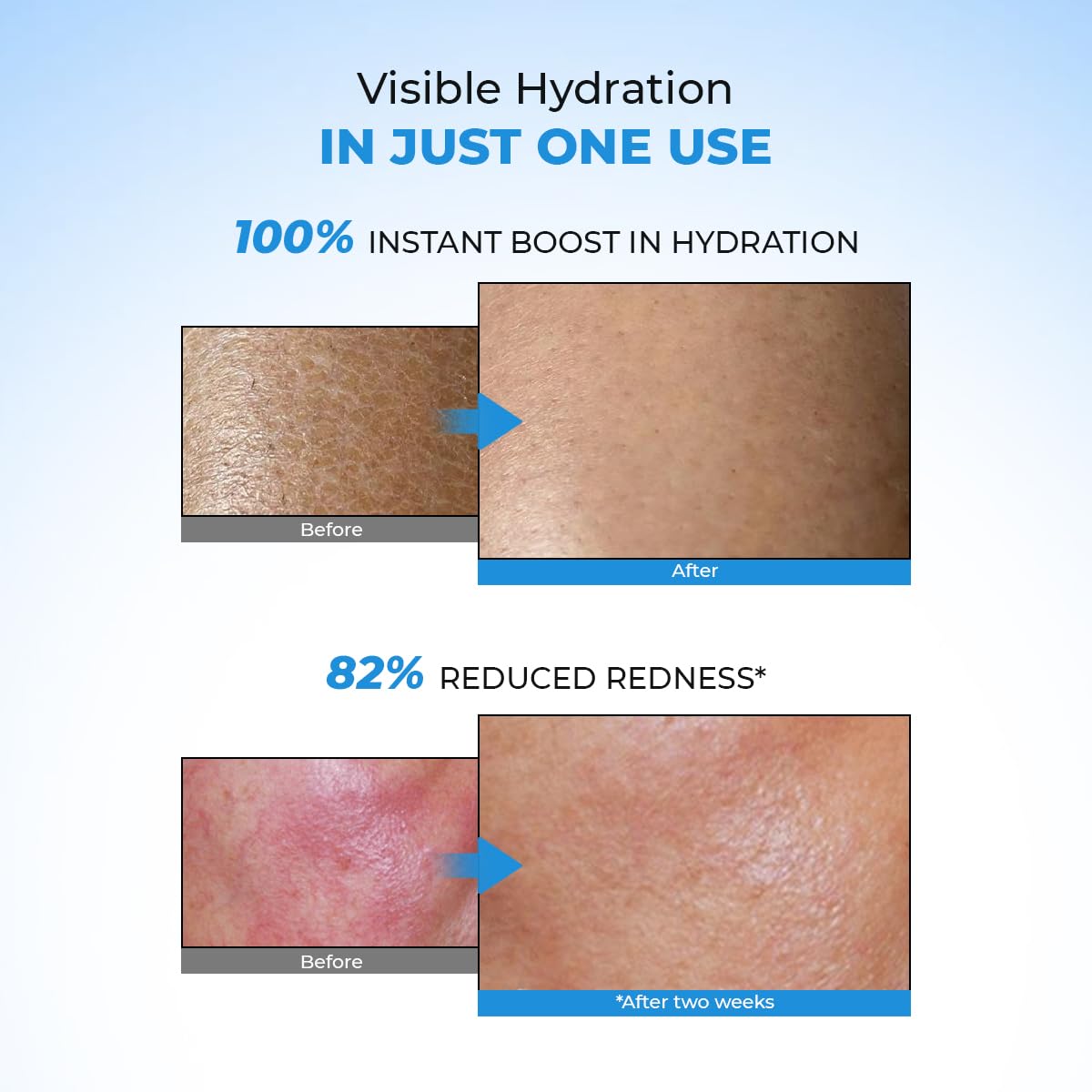 Conscious Chemist Hyaluronic Acid Moisturizer | 100g | Moisturizer for Dry Skin Face, Ceramide Moisturizer, Face Cream for Men & Women, Treat Dull, Dehydrated Skin, For Normal to Dry Skin - Hydro+