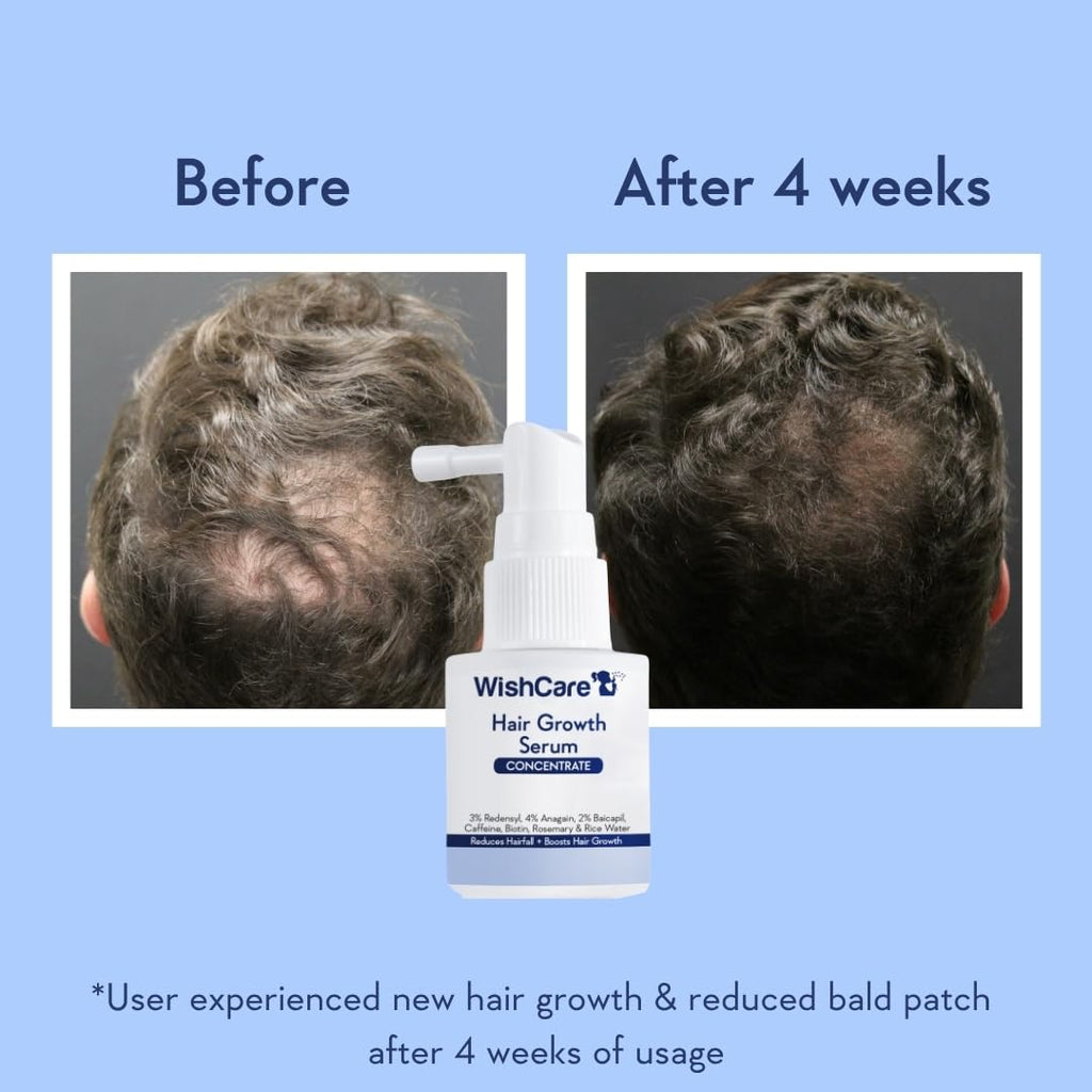WishCare Hair Growth Serum Concentrate - Resdensyl, Anagain, Caffeine, Biotin, Keratin & Rice Water 20ml