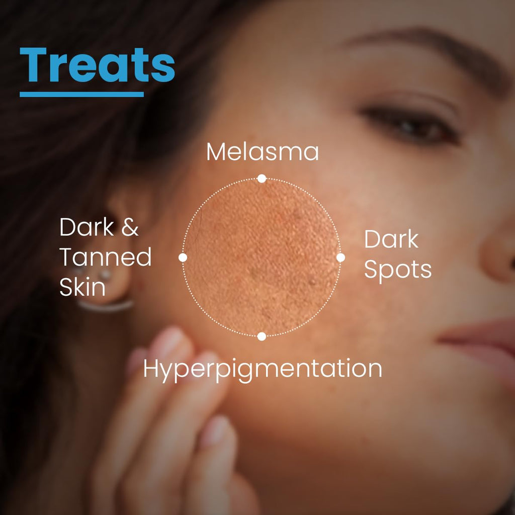 FCL AHA Lightening Gel | Glycolic Acid | Treats Hyperpigmentation, Dark spots, Tanned Skin, Reduce Dark Spots Age spots & freckles Uneven skin tone | Aha lightening gel 15 ml (Pack of 1)