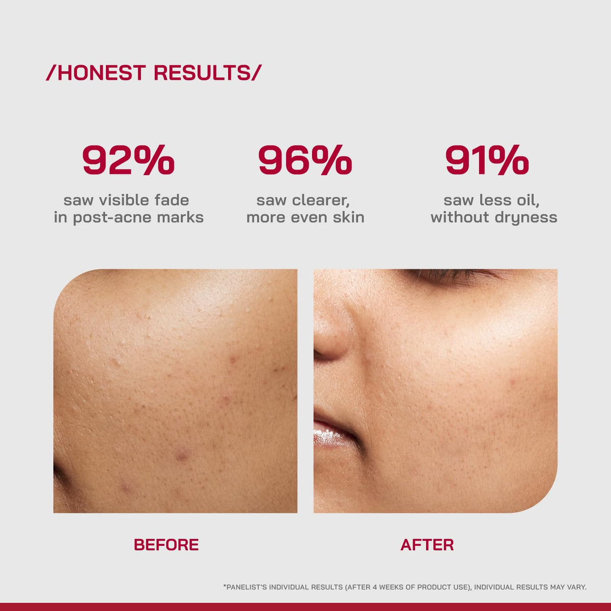 /PHD/ 10% Niacinamide Spot Correcting Serum | Niacinamide Serum for Oily Skin, Acne Scars & Enlarged Pores | Face Serum for Acne Prone Skin with 2% NAG | Brightens & Smoothens Skin | Fades Marks, Controls Oil, Removes Blemishes & Pore Care I 30ml