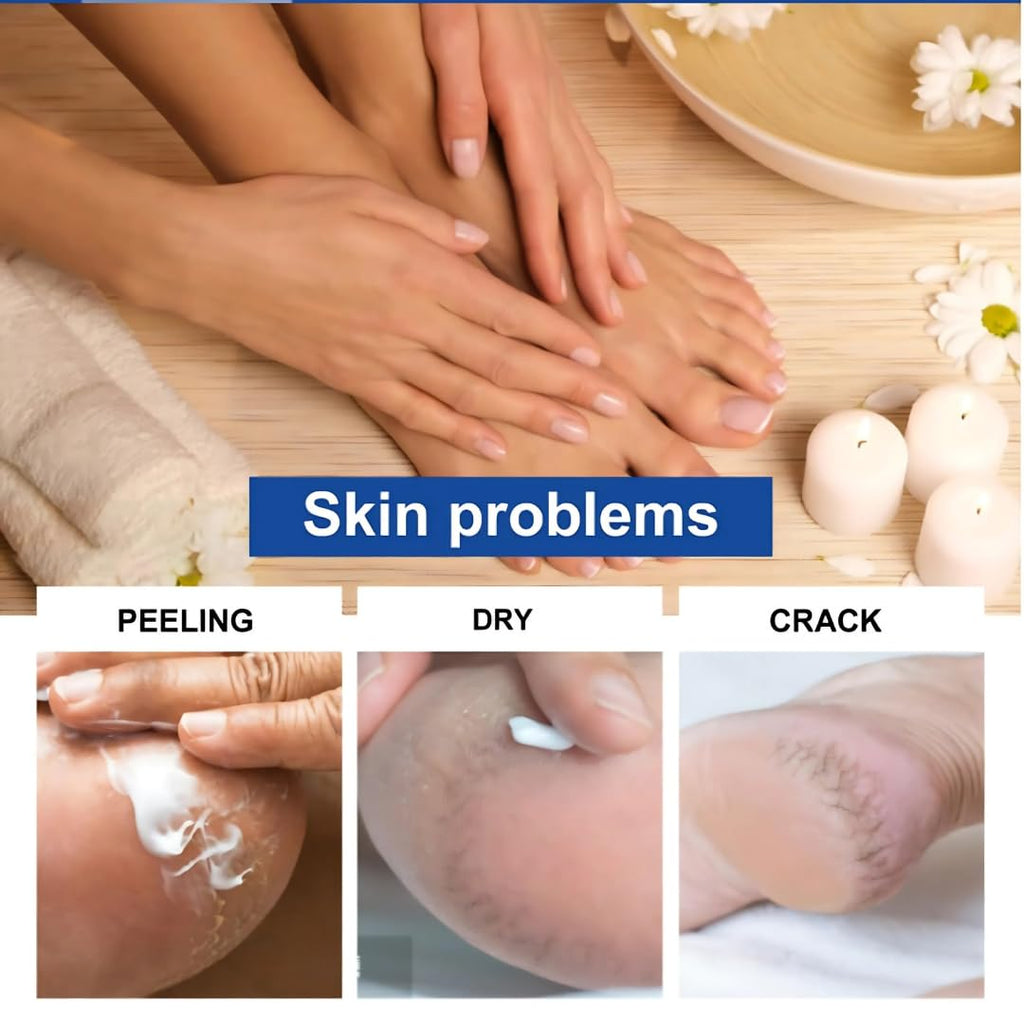 Smartdrops Foot Cream for Dry & Cracked Feet | Crack Heel Repair Cream | Enriched with Aloe, Shea Butter & Vitamin E | Foot Care Cream for Deep Absorbing, Cooling & Vegan Formula (50g)