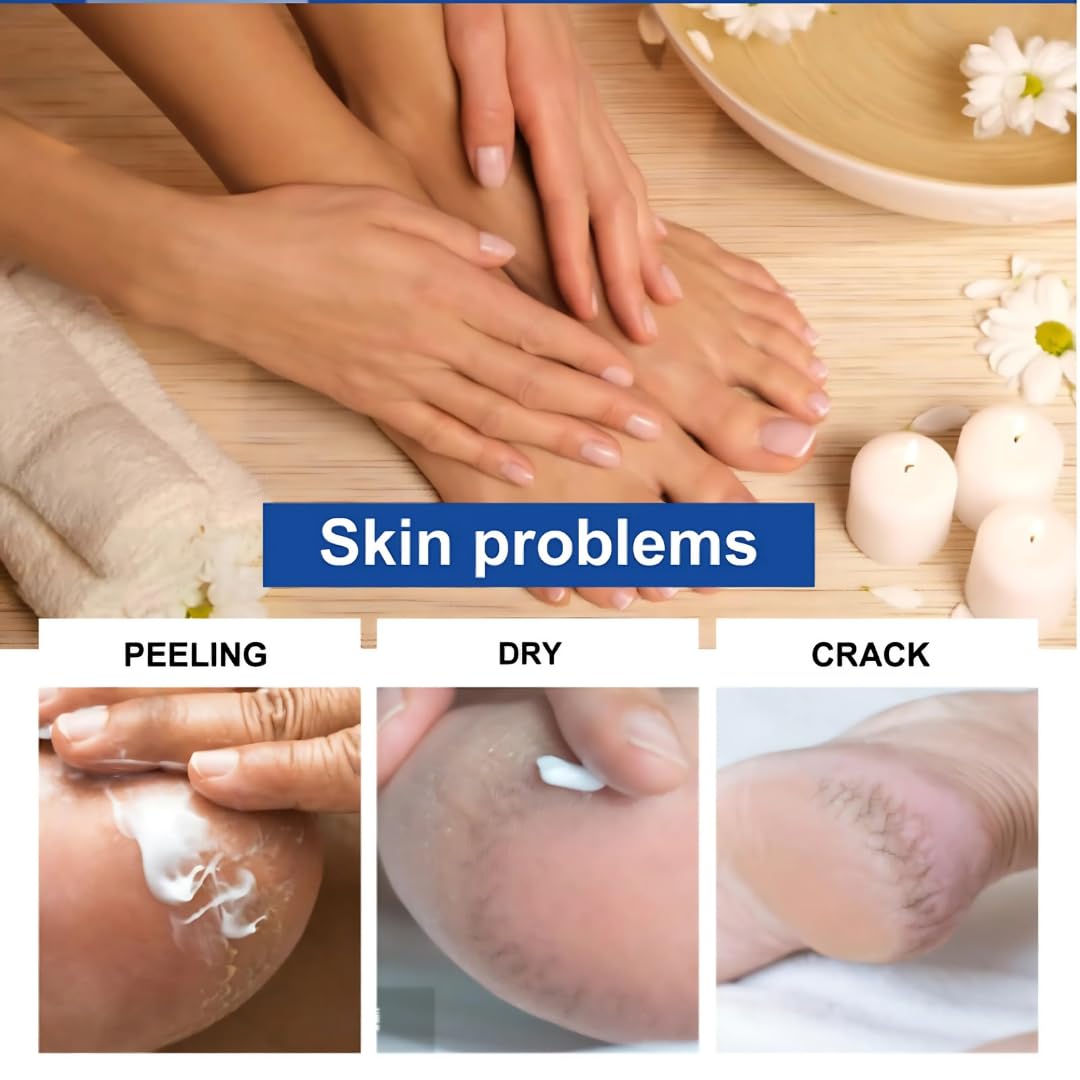 Smartdrops Foot Cream for Dry & Cracked Feet | Crack Heel Repair Cream | Enriched with Aloe, Shea Butter & Vitamin E | Foot Care Cream for Deep Absorbing, Cooling & Vegan Formula (50g)