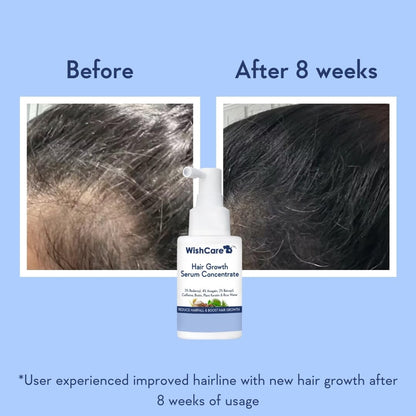 WishCare Hair Growth Serum Concentrate -30ml
