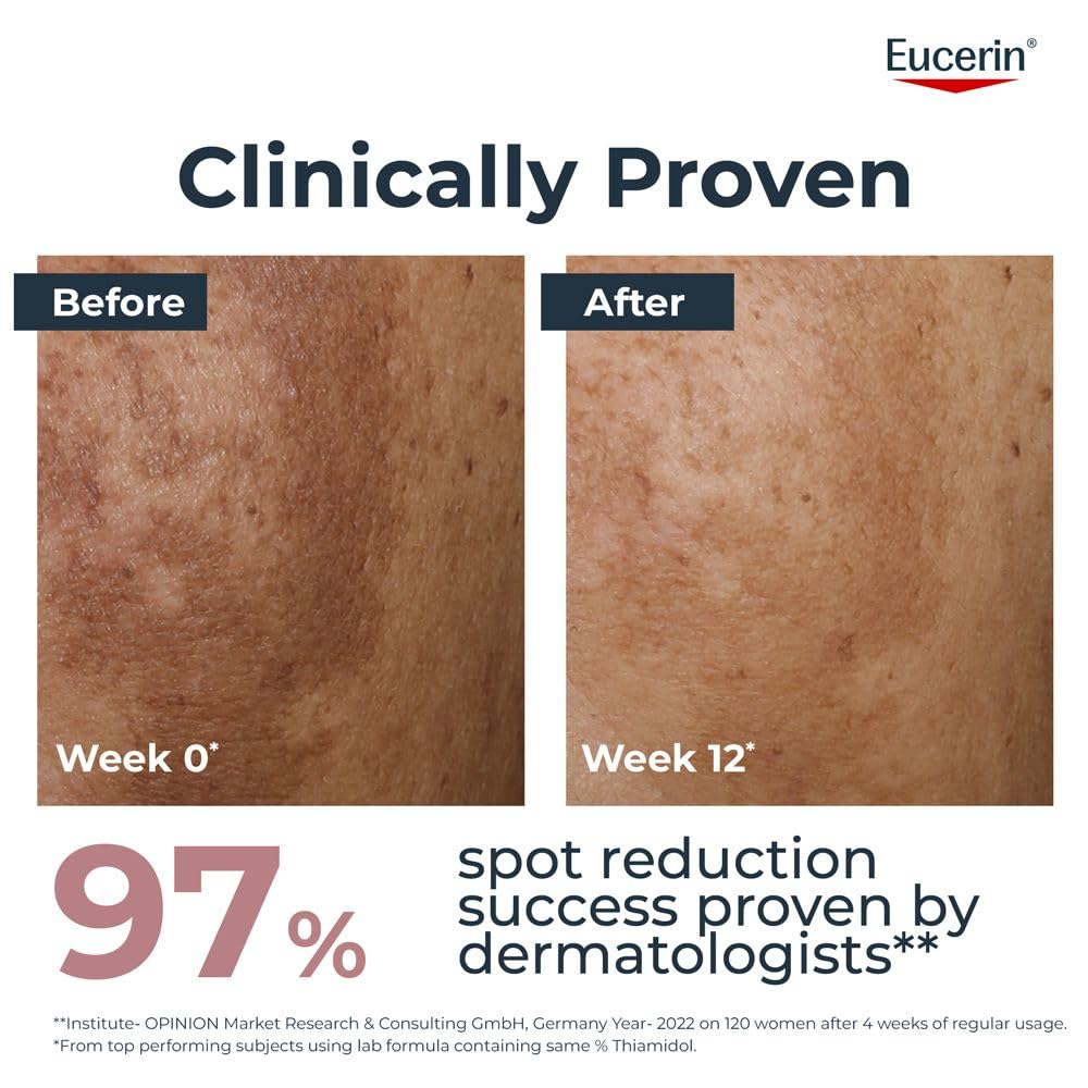 Eucerin Anti-Pigment Face Cream with Thiamidol & SPF 30, Reduces Dark Spots 50ml