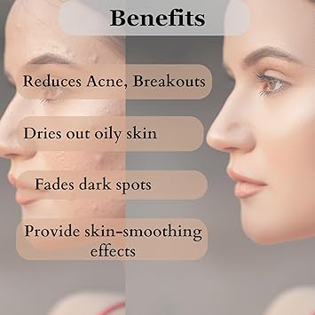 Dermistry Salicylic Acid Niacinamide Anti Acne Deep Cleanser Foaming Face Wash - 150 ml
