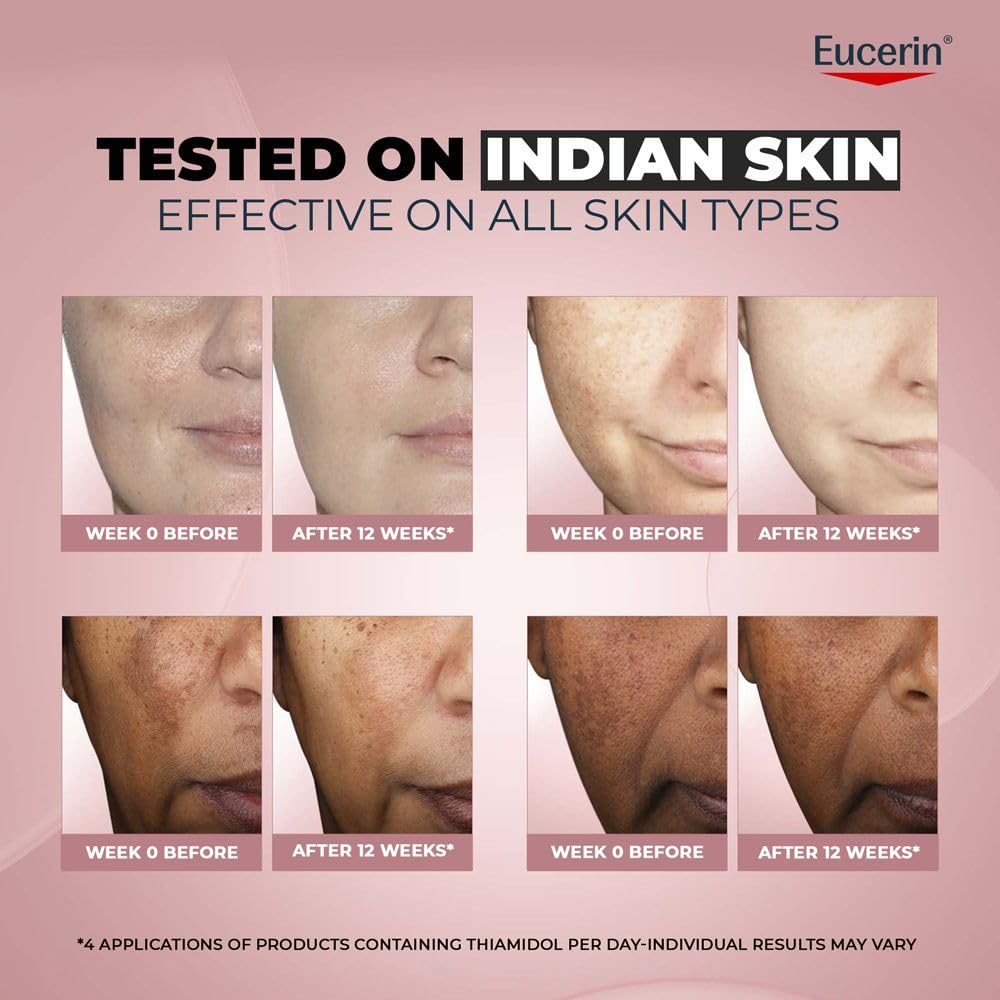 Eucerin Anti-Pigment Face Cream with Thiamidol & SPF 30, Reduces Dark Spots 50ml
