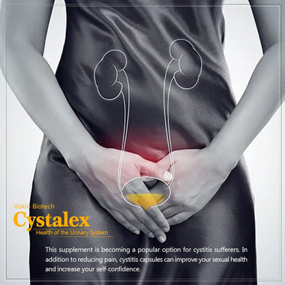 Vokin Biotech Cystalex Capsules - 60 Capsules