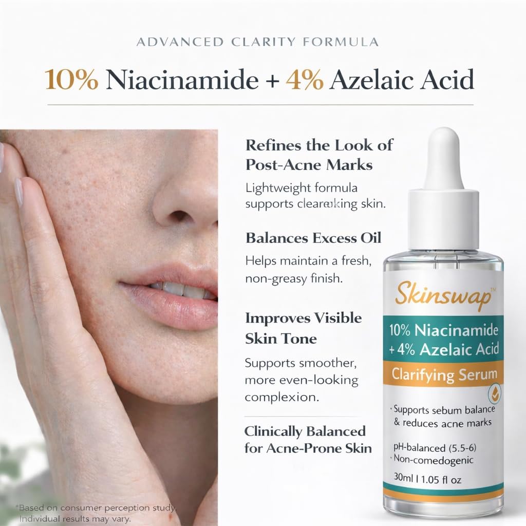 Skinswap Active 14% Niacinamide Serum with Azelaic Acid | Clarifying Face Serum for Brightening & Oil Control | Helps Reduce Acne, Blemishes & Acne Marks | Smooth, Clear-Looking Skin | For Women & Men | 30 ml