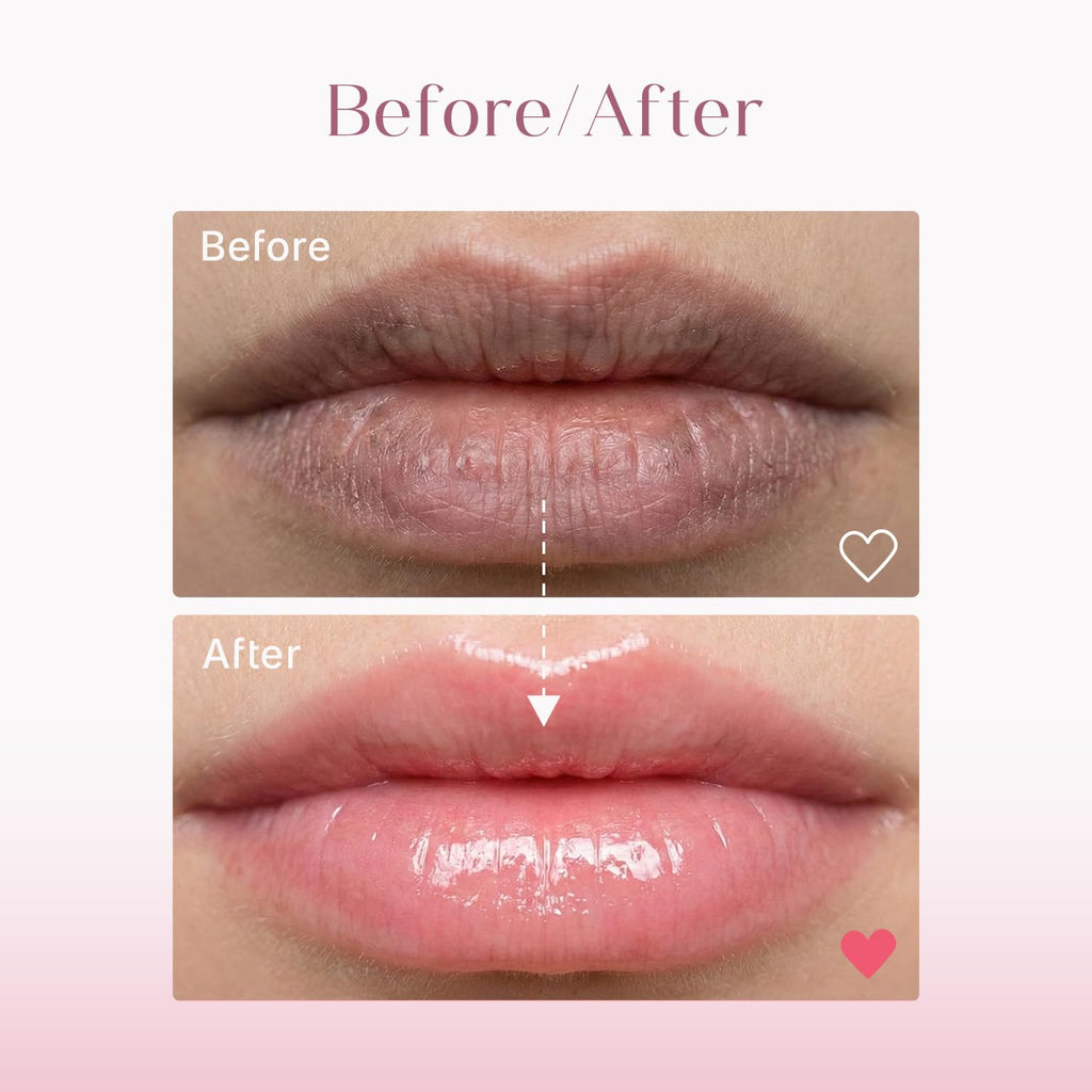 Seoulskin Brightening Lip Balm with SPF 50 PA++, Kojic Acid & Niacinamide | Brightening Lip Balm for Dark Lips | Repairs Chapped Lips | For Dark Lip Lightening & Protection | 10g