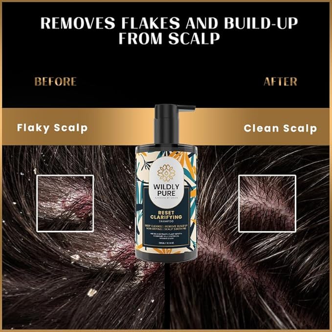 Wildly Pure Clarifying Shampoo for Hard Water & Metal Damage | Men & Women | 300 Ml | Reset