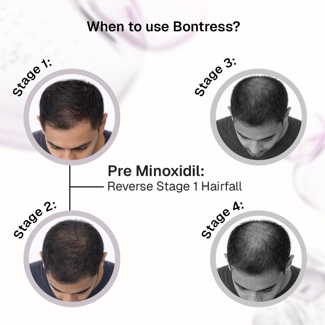 Bontress PRO+ Scalp Serum | Powered by Pro Active Peptides – 5% Capixyl, 3% Redensyl, 3% Anagain, 3% Procapil | Dermat recommended Hair Growth Serum | 94% Users Reported Hair Growth in 28 Days | 30ml