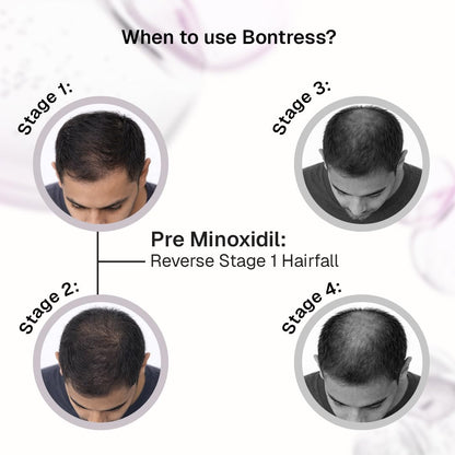Bontress PRO+ Scalp Serum | Powered by Pro Active Peptides – 5% Capixyl, 3% Redensyl, 3% Anagain, 3% Procapil | Dermat recommended Hair Growth Serum | 94% Users Reported Hair Growth in 28 Days | 30ml