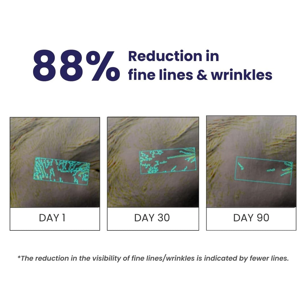 RE' EQUIL 0.1% Retinol Night Cream | Repairs Wrinkles & Fine Lines | Improves Skin Firmness | Beginner Friendly | All Skin Types | Anti Aging Cream For Women & Men 32G