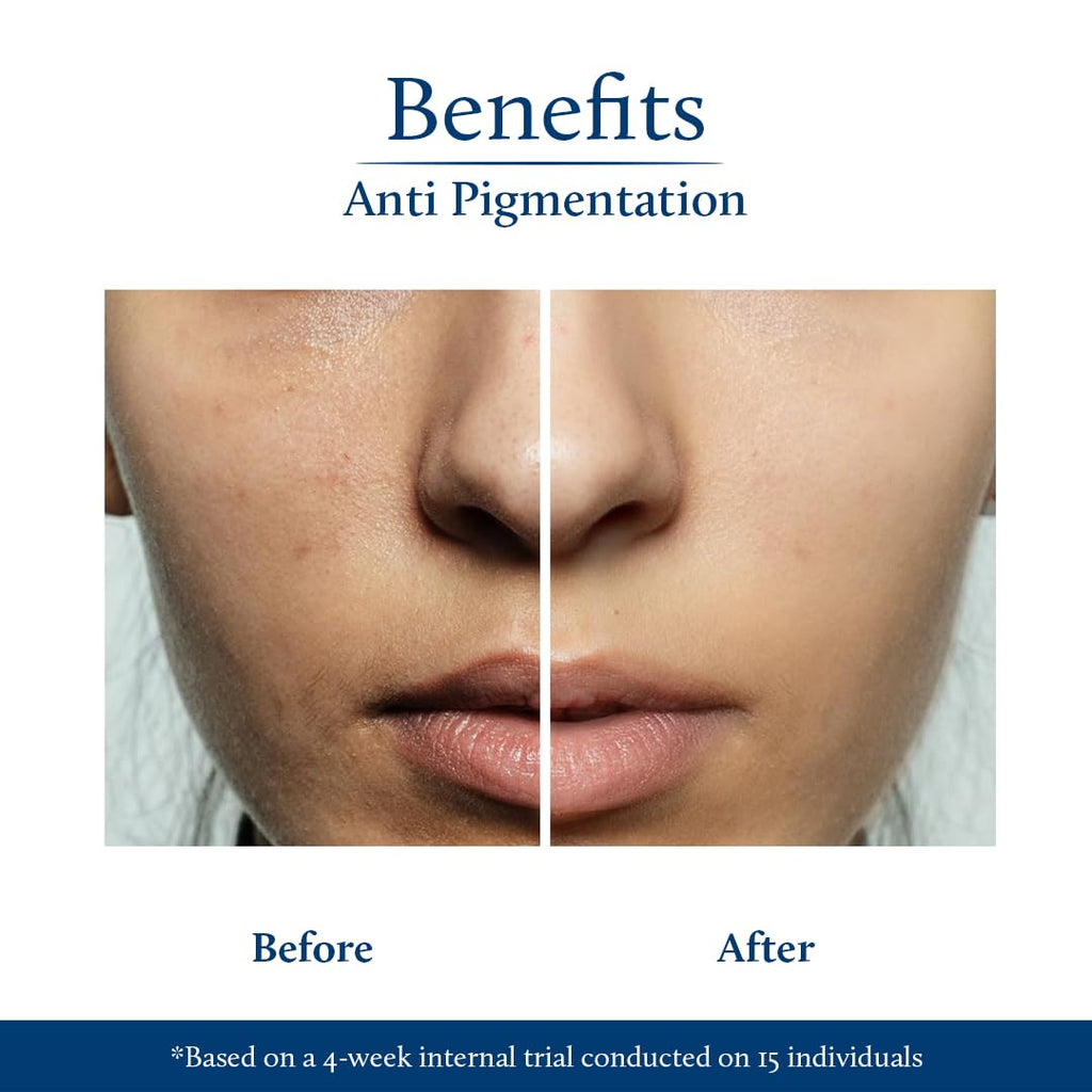 Blue Nectar Rice Water Kojic Acid Face Serum for Pigmentation & Dark Spots Removal | Anti Pigmentation Serum for Face with Mushroom (13 Herbs, 30ml)