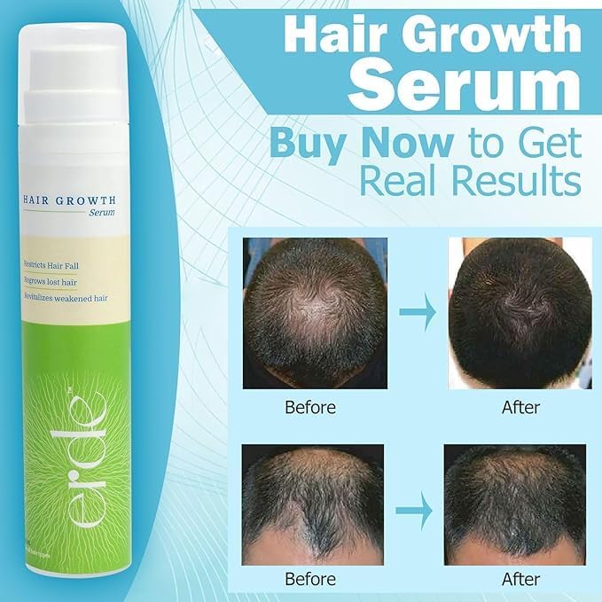 Erde Regrow Hair Serum - 60 ml (Pack of 2)
