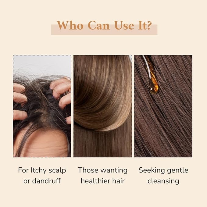 Zanya Anti Hair Fall Shampoo Reduces Hair Fall and Breakage - 250 Ml