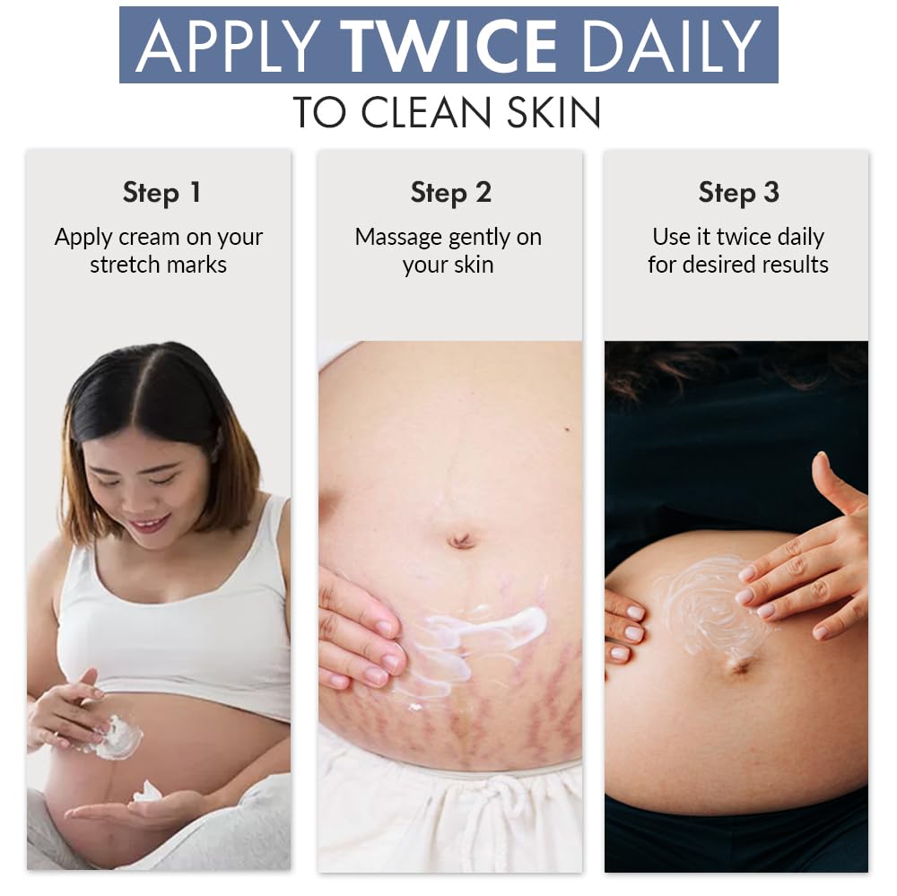 ThriveCo Stretch Marks Expert Serum Cream | Clinically Proven Treatment for New red & Old white Stretch Marks & Scars Removal | Infused with Collarev®, Striover™, Rosehip Oil | Women & Men (Stretch Marks 30ML)