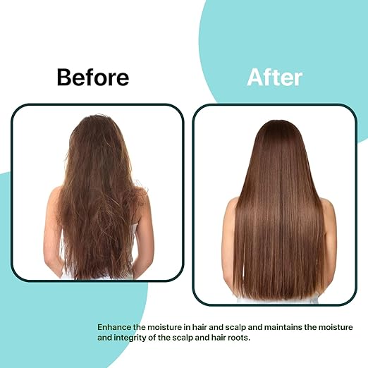 Rahul Phate's Research Product Ana-Zoom Scalp Care Arginine Pentothenate Shampoo - 200 ml
