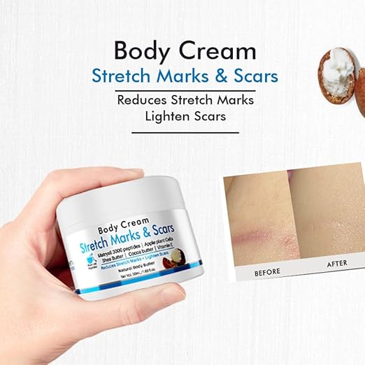 Volamena Stretch Marks & Scars Body Cream - 50 ml