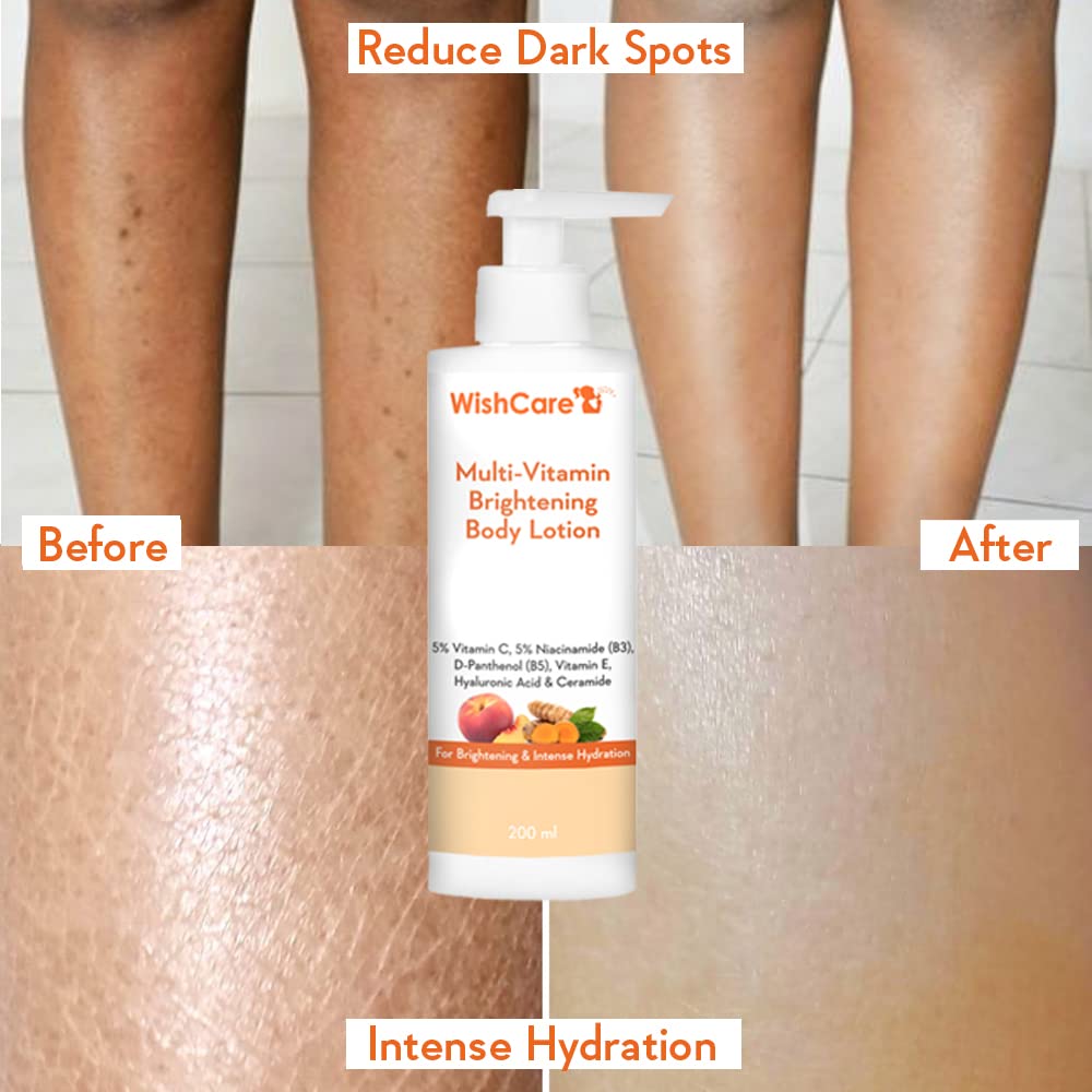 WishCare Multi-Vitamin Brightening Body Lotion - 200 ml