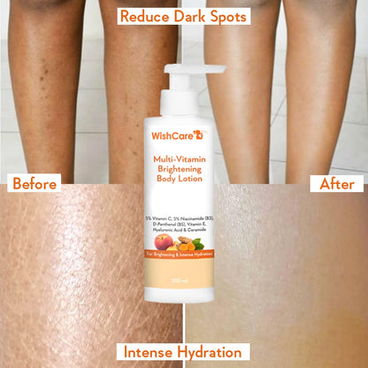 WishCare Multi-Vitamin Brightening Body Lotion - 200 ml