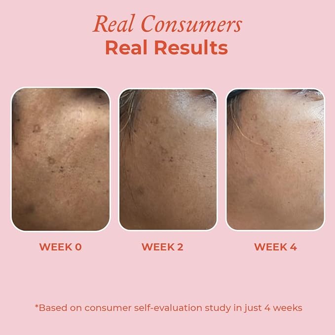 The Pink Foundry 15% Vitamin C Face Birghtening Serum for Glowing Skin - 30 Ml