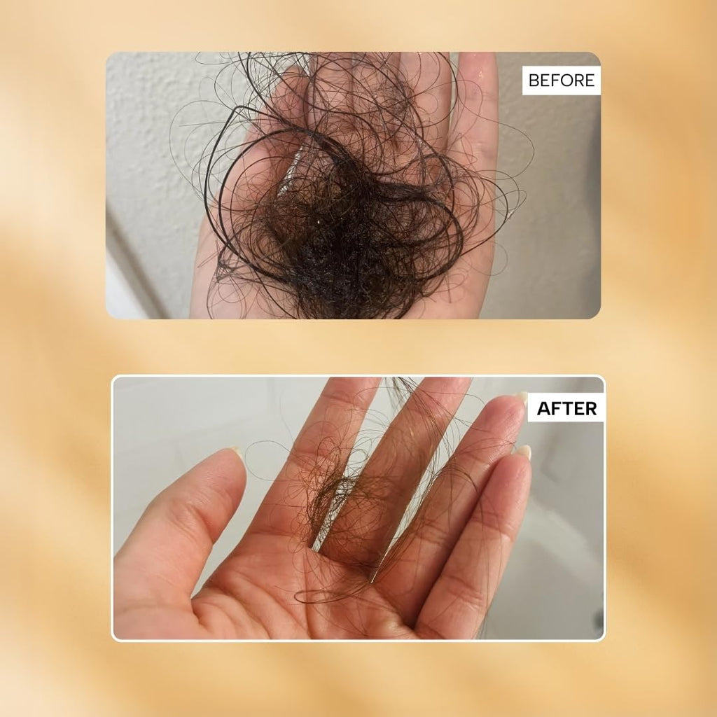 RAS Root-ineâ„¢ Hair Growth Serum with 19.5% Scalp Actives | Redensyl & Anagain | Promotes Hair Growth, Stimulates Hair Follicles & Regrowth | Controls Hair Fall & Increases Hair Density | Hair Growth Serum for Women & Men