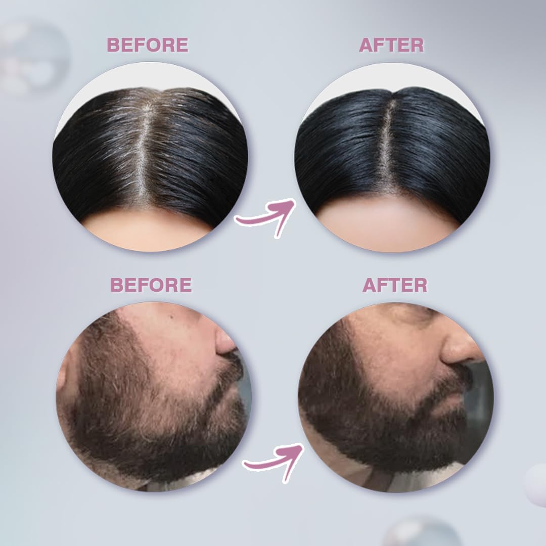 Glamveda Cover-Up Hair Powder Black | Instantly Covers Grey Roots, Bald Spots & Thinning Hair | Hairline Filler for Fuller & Denser Looking Hair | Highly Pigmented Matte Finish | Long-Lasting Coverage | 4g