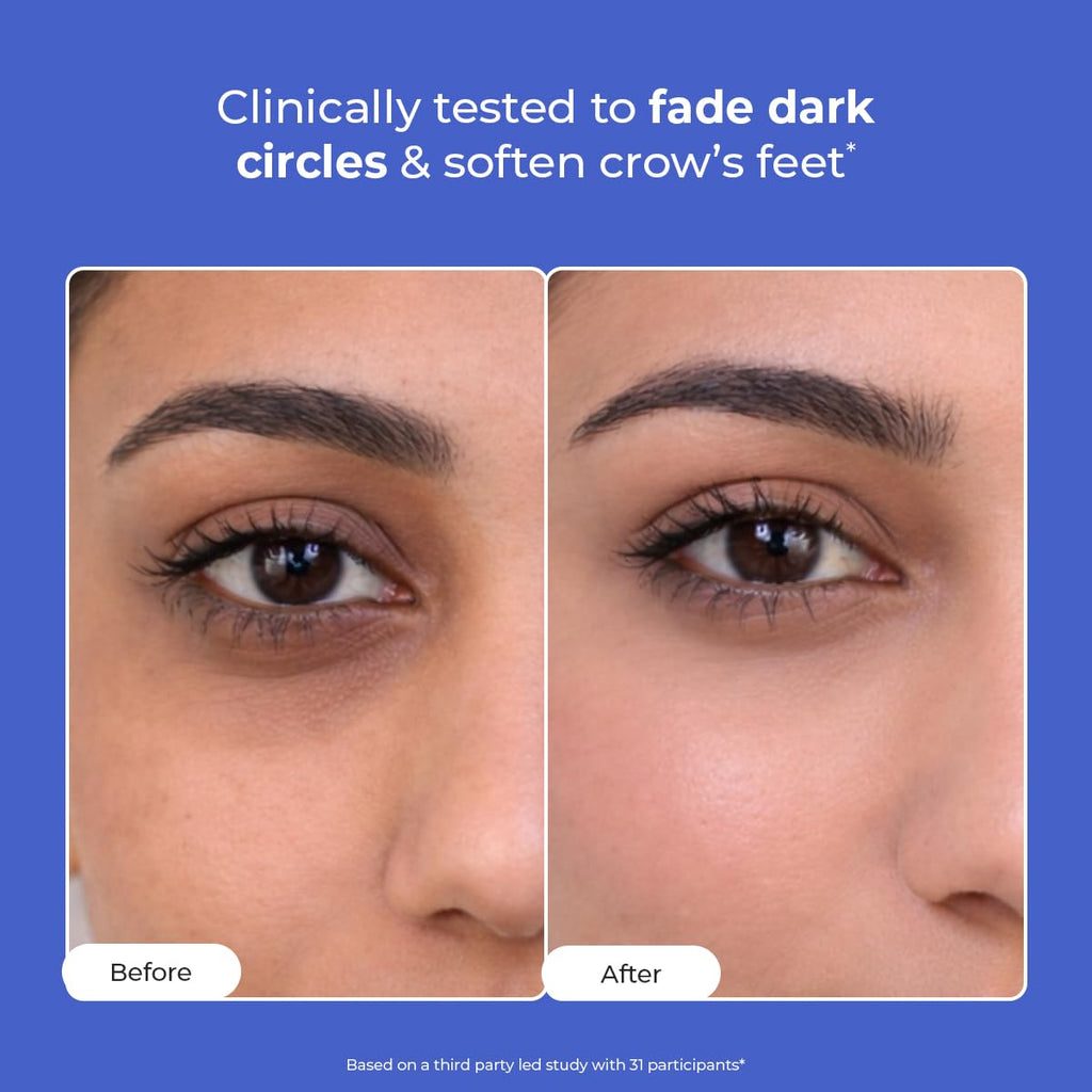 Conscious ChemistÂ® Retinol Peptide Under Eye Cream With Soothing Massage Roller | Under Eye Roll On For Dark Circles, Fine Lines & Puffy Eyes | For Women & Men | 15 ml