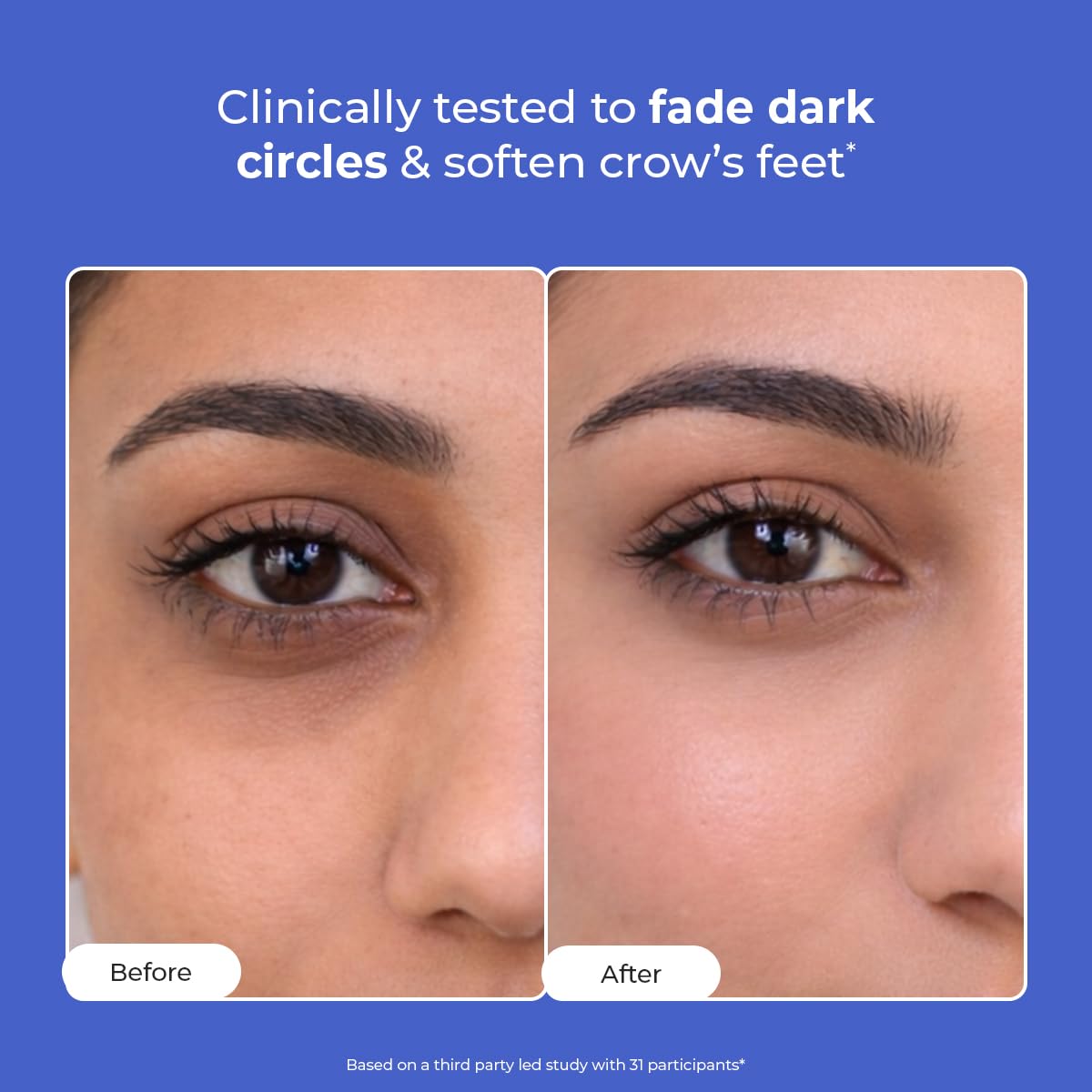 Conscious ChemistÂ® Retinol Peptide Under Eye Cream With Soothing Massage Roller | Under Eye Roll On For Dark Circles, Fine Lines & Puffy Eyes | For Women & Men | 15 ml
